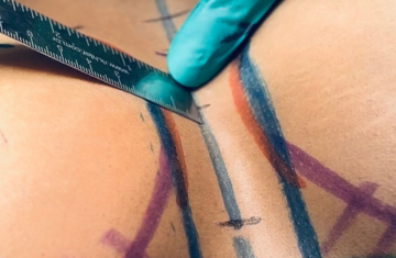 Imagem detalhes - Cirurgia Plástica das Mamas 